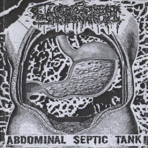 Abdominal Septic Tank