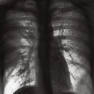 NON POSSO MORIRE COSÌ