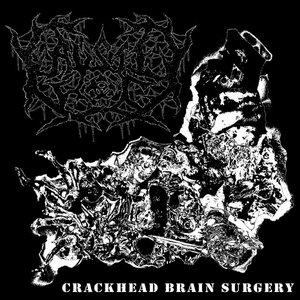 Crackhead Brain Surgery