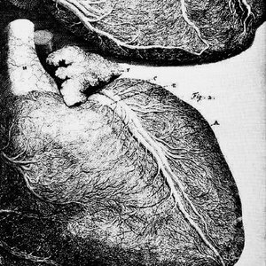 AORTA
