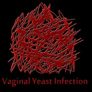 Vaginal Yeast Infection