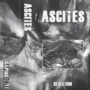 Resection