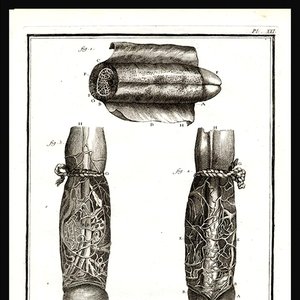 Avatar for Dead Body Collection & Masturbatory Dysfunction