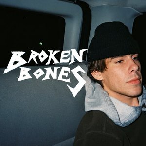 Broken Bones