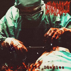 The Incision Diaries