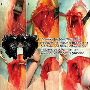 The Major Duodenal Papilla Is An Opening Of The Pancreatic Duct Into The Duodenum, The Primary Mechanism For The Secretion Of Bile And Other Enzymes That Facilitate Digestion