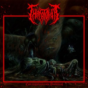 Estrangulamiento Umbilical