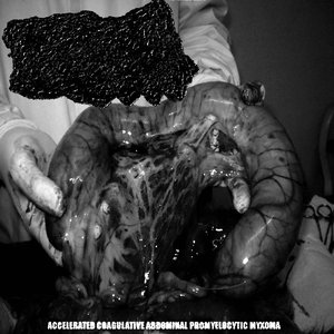 Accelerated Coagulative Abdominal Promyelocytic Myxoma
