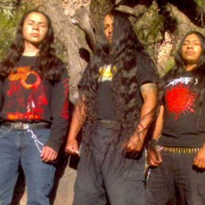 Avatar de Paracoccidioidomicosisproctitissarcomucosis