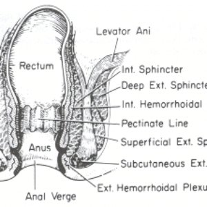 Image for 'Rectum Inspection'
