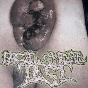 Sphincter Carcinoma