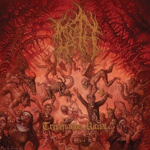 Trepanation Ritual