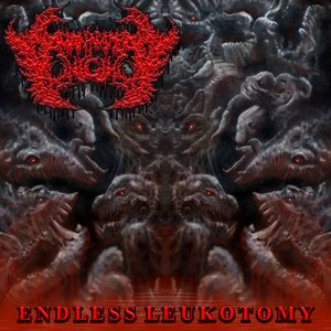 Endless Leukotomy