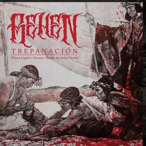 Trepanacion EP