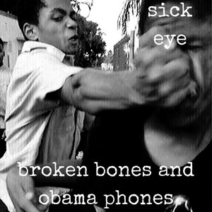 broken bones and obama phones