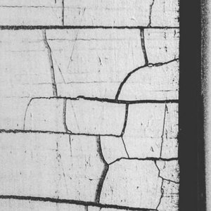 Cotard Delusion