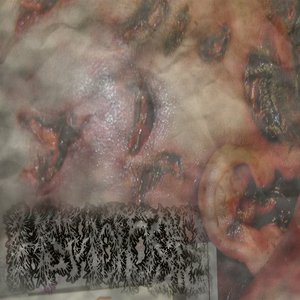Hematosis