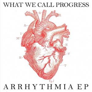 Arrhythmia EP