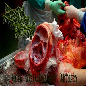 Image for 'Head Disfigurement Autopsy'