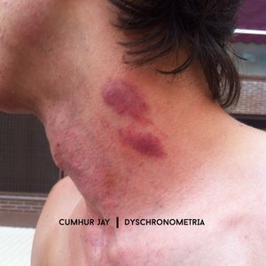 Dyschronometria