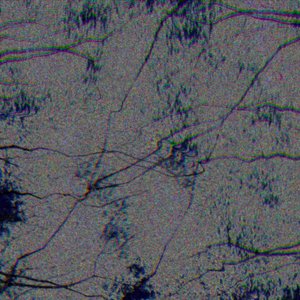 Black Mold