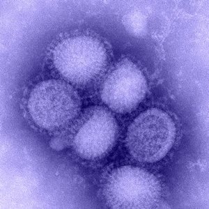 H1N1 Single