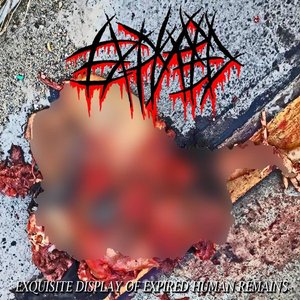 Exsquisite Display Of Expired Human Remains