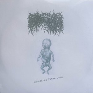 Macerated Fetus Demo