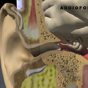 Avatar for audiofon