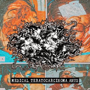 Medical Teratocarcinoma Anus 的头像