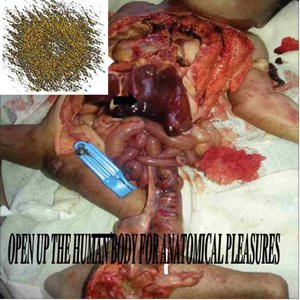 Open up the human body for anatomical pleasures