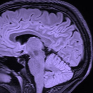 BRAIN EP