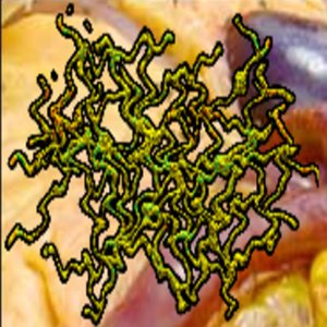Repulsive Glomerulonephritis 的头像