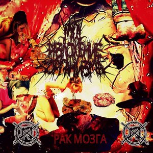 РАК МОЗГА