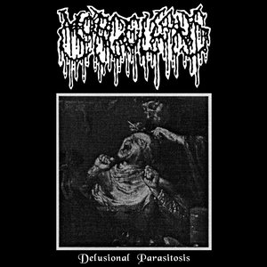 Delusional Parasitosis