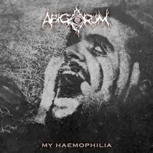 My Haemophilia