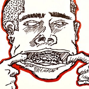 Braces - Single