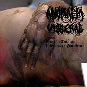 Erupção Cutânea Infecciosa E Purulenta