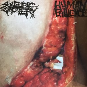 Sulfuric Cautery/Human Effluence Split