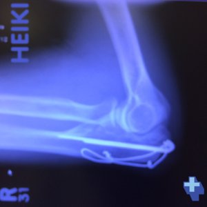 Cracked Elbow