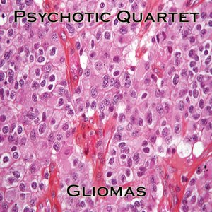 Gliomas
