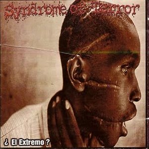 ¿El Extremo?