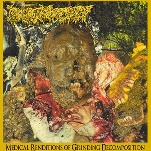Medical Renditions of Grinding Decomposition
