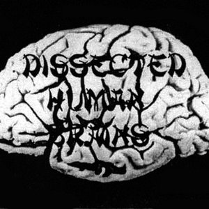 Avatar für Dissected Human Brains