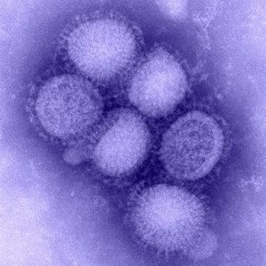 H1N1 - Single