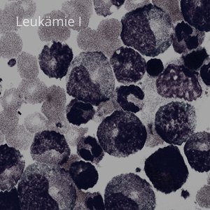 Leukämie I