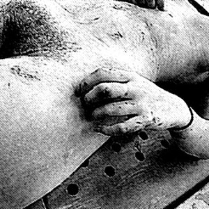 The Fixation