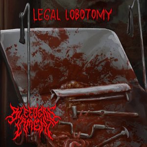 Legal Lobotomy - Single