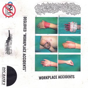 Workplace Accidents