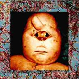 Fetus Reproductions
